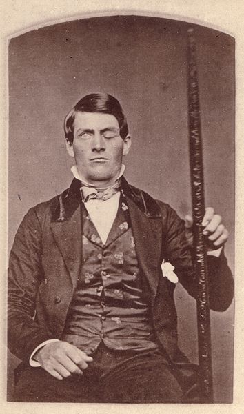 Phineas Gage, and his lucky